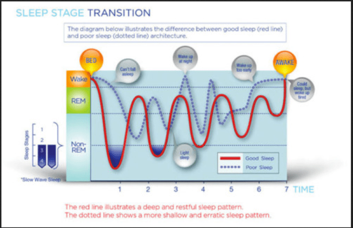 sleep stage transition