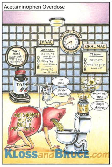 "LiverMan" by Brian Kloss Sample Toxicology Flashcard from Life in the Fast Lane