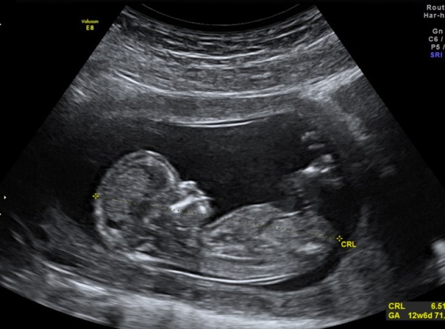 Screen Shot 2014-07-07 at 19.23.24